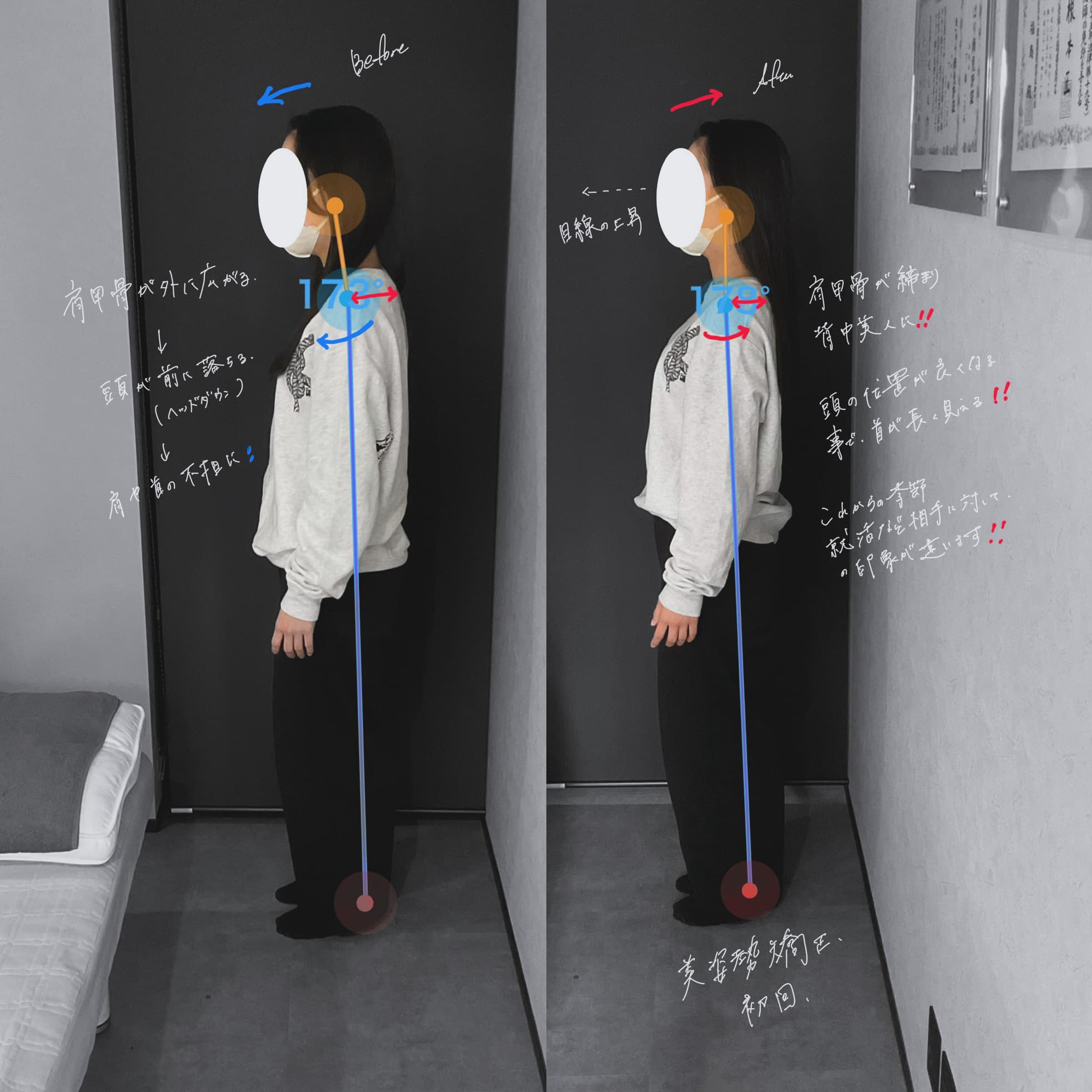 姿勢の変化を分析したビフォーアフター写真